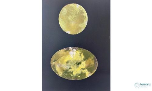 Ancient Lichen Mono Print by Mandi Stewart